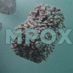 casos de Mpox