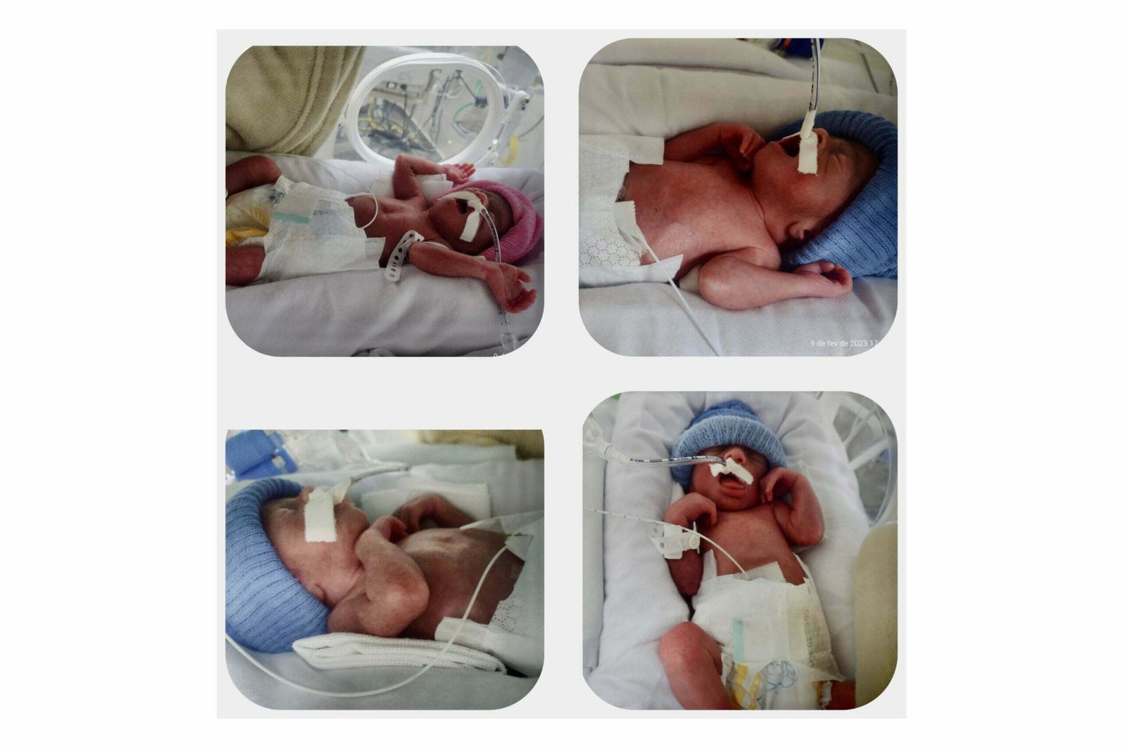 Hospital de Cascavel realiza parto de quadrigêmeos