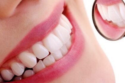 Sorriso dos famosos: saiba os benefícios da harmonização dental