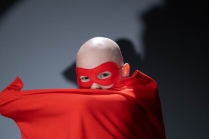 Alopecia areata atinge 1% dos brasileiros