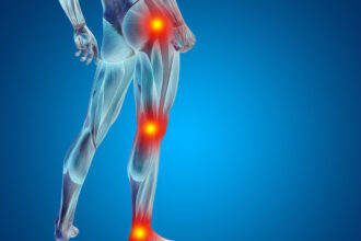 Inverno pode acentuar as dores nas articulações do joelho e quadril