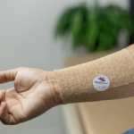 Tratamentos avançados para feridas ajudam na cicatrização