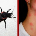 Doença de Chagas