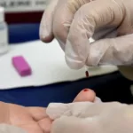 Curitiba já teve 204 casos de Hepatite A em 2024