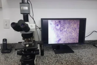 Paraná amplia exame de DNA-HPV para todos os municípios do estado