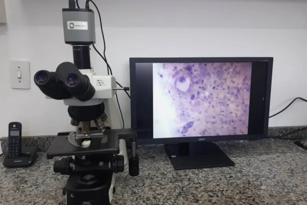 Paraná amplia exame de DNA-HPV para todos os municípios do estado