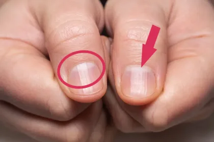 Lúnulas “Meia-lua da unha”